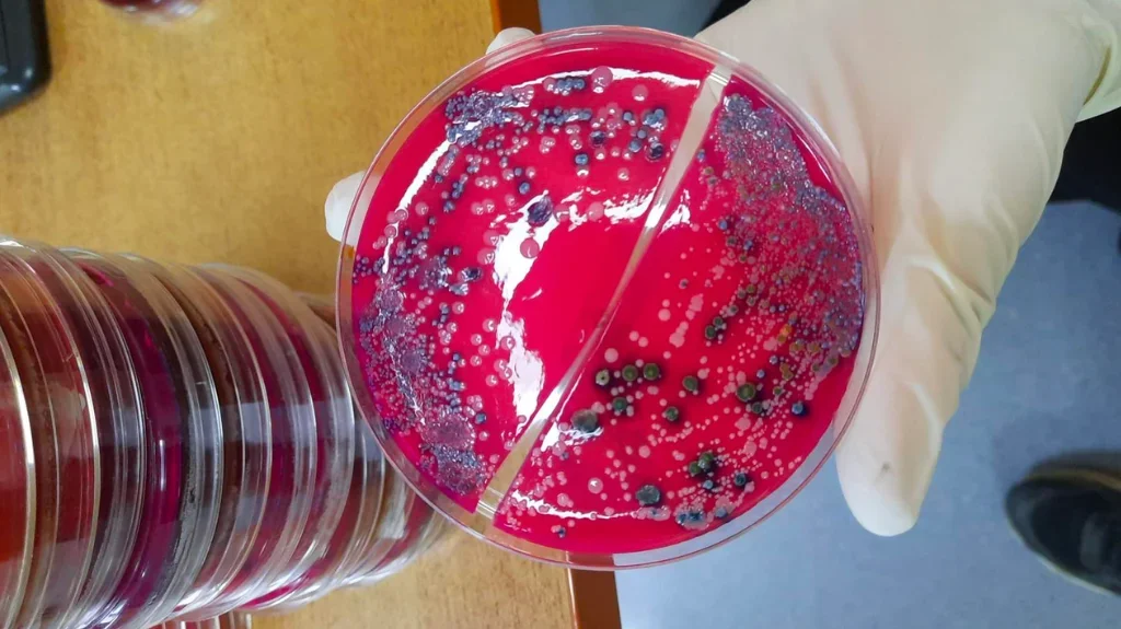 About Microbiological Culture Media