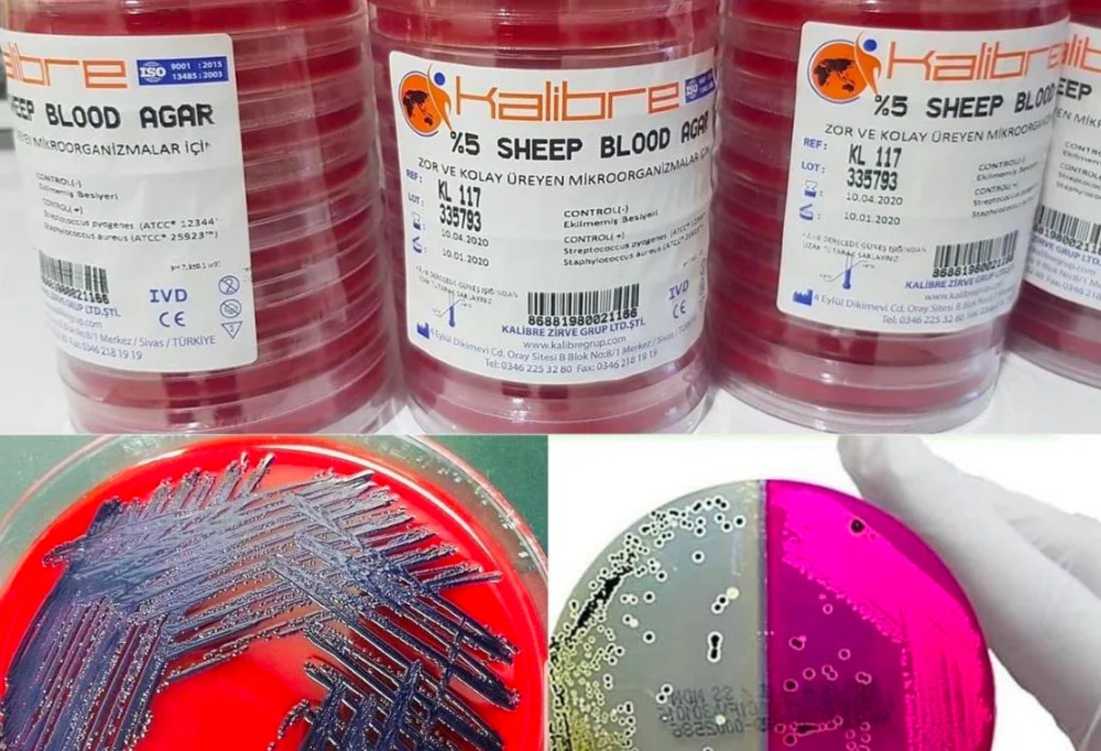 5% Sheep Blood Agar Products