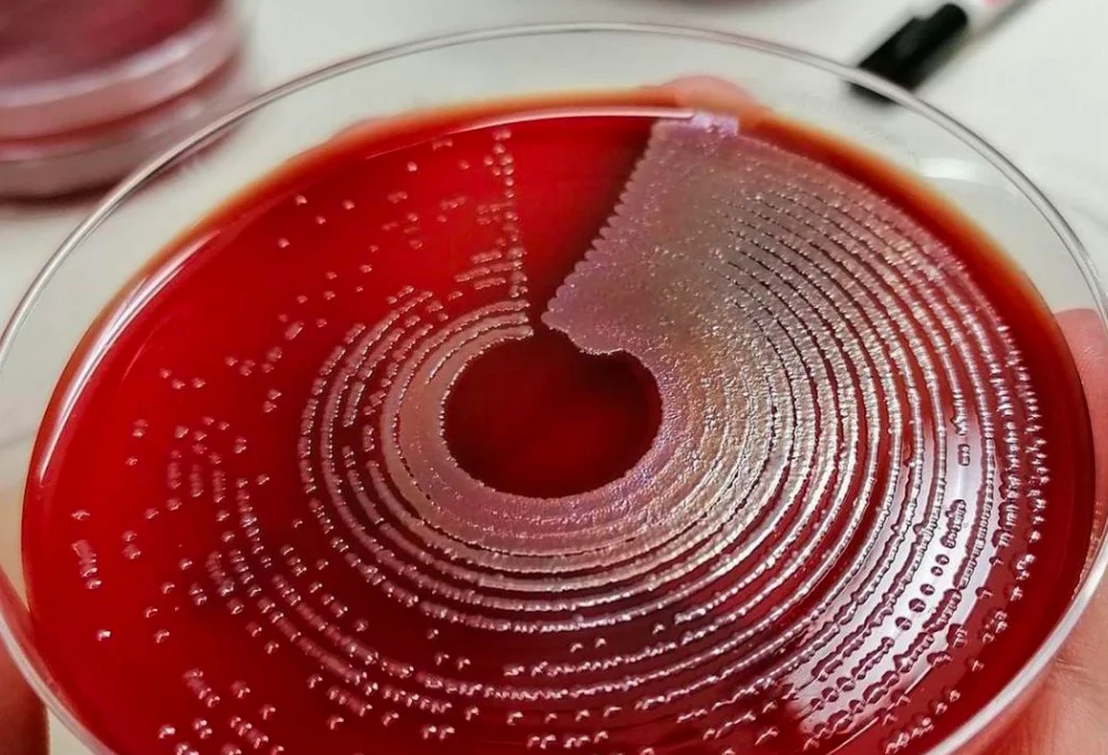 Bacterial Growth on Blood Agar